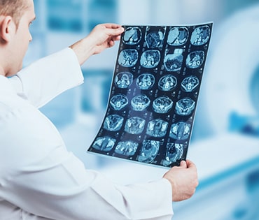 Service Detail Image 2, best cancer hospital in hyderabad, Brain tumour specialist in hyderabad, Best Brain Tumour Specialist
